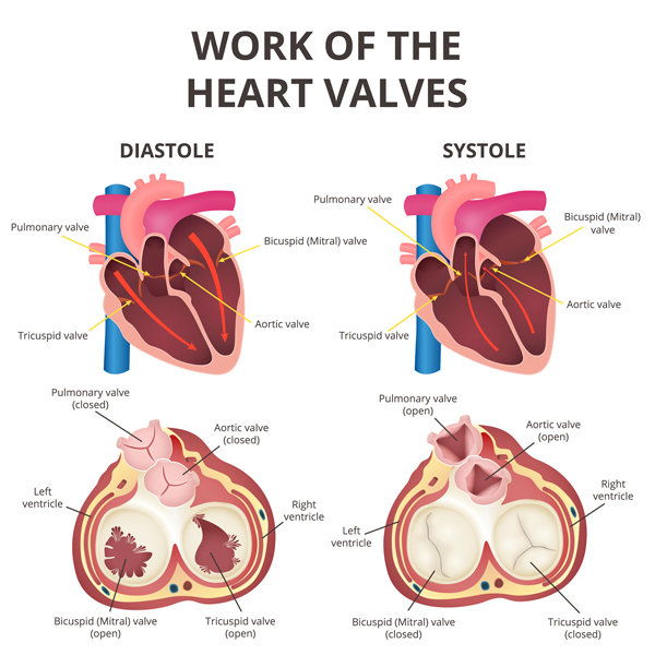 Insertion De Valve Dans Une Valve Cardiaque Endommagée